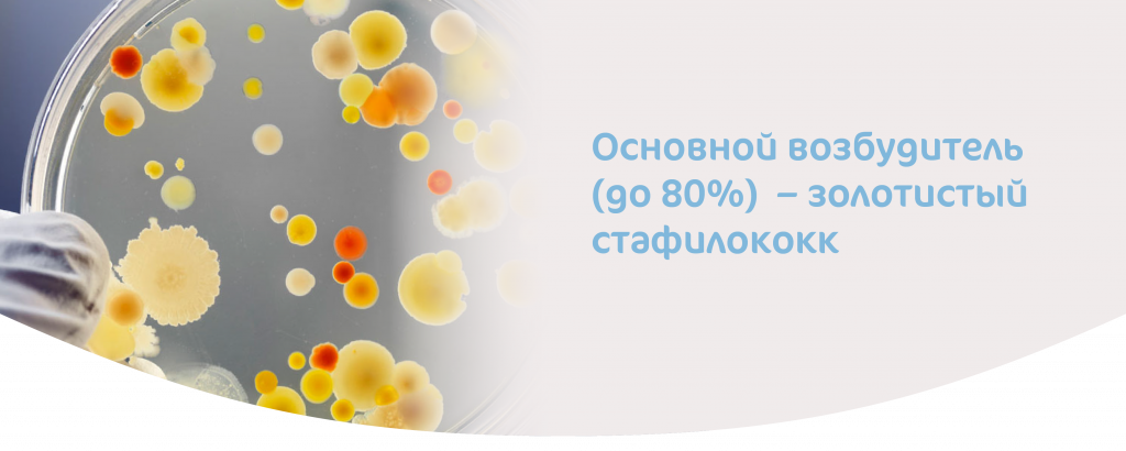 МАСТИТ_У МАТЕРЕЙ-02.png