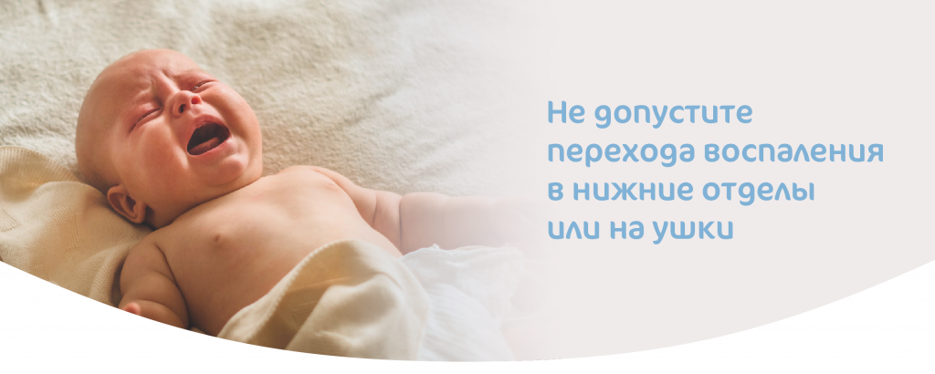 Причины насморка